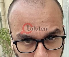Best Hair Transplant In UAE With Low Cost - Image 2