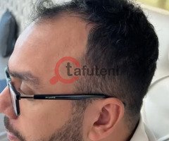 Best Hair Transplant In UAE With Low Cost - Image 3